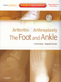 Arthritis & arthroplasty: the foot and ankle