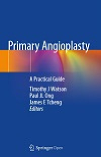 Primary angioplasty a practical guide