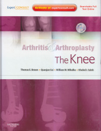 Arthritis & arthroplasty: the knee