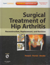Surgical treatment of hip arthritis: reconstruction
